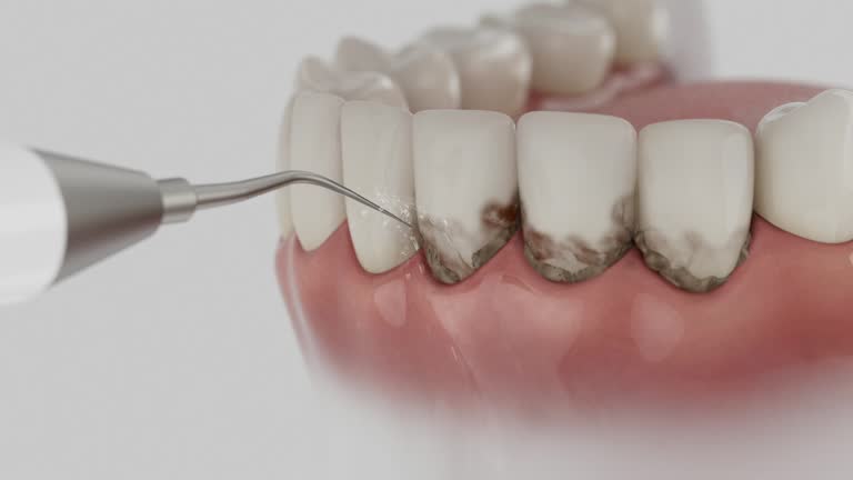 Reliable Teeth Cleaning And Checkup contractor in Dawson County County, GA by Dentist Open Now